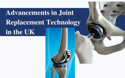 Advancements in Joint Replacement Technology in the UK