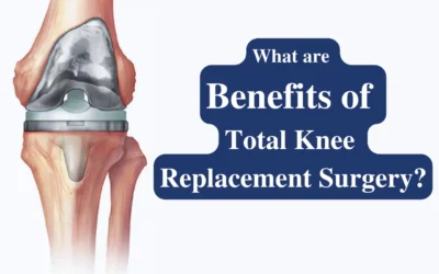 What are Benefits of Total Knee Replacement Surgery?