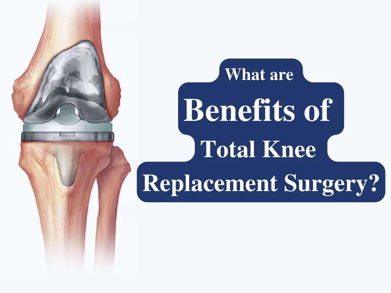 Benefits of Total Knee replacement
