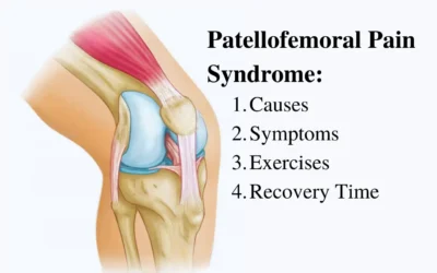 Patellofemoral Pain Syndrome: Causes, Symptoms, Exercises, and Recovery Time