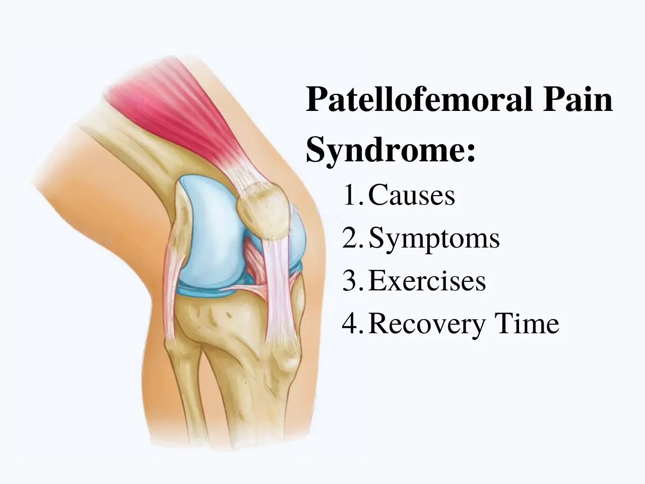 Patellofemoral Pain syndrome