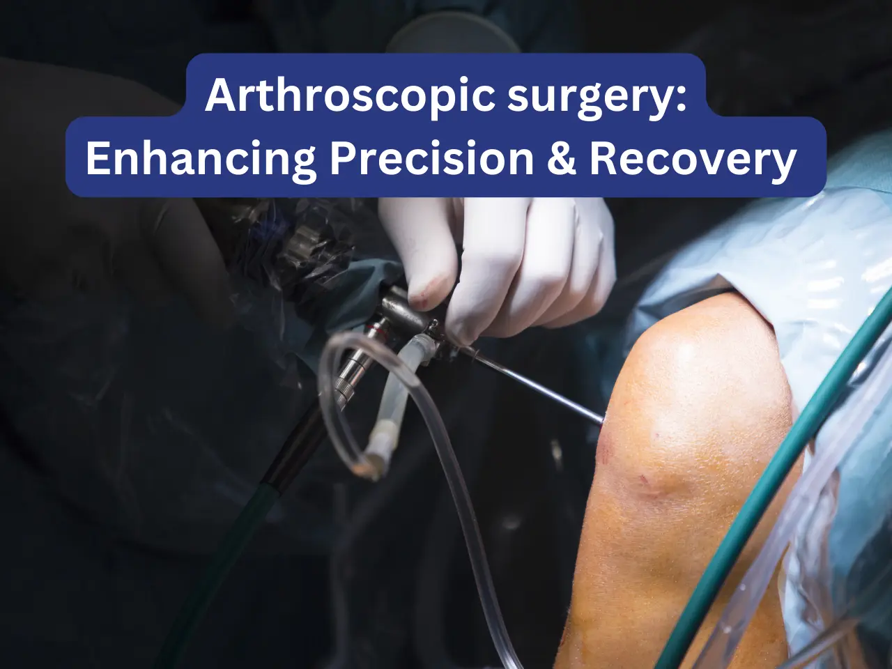 Arthroscopic Precision & Recovery