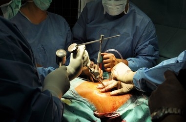 Hip replacement surgery preparation