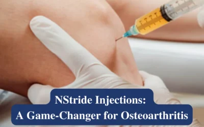 NStride Injections: A Game-Changer for Osteoarthritis