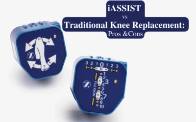 iASSIST vs Traditional Knee Replacement: Pros and Cons