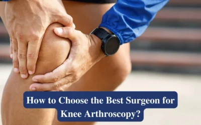 How to Choose the Best Surgeon for Knee Arthroscopy?