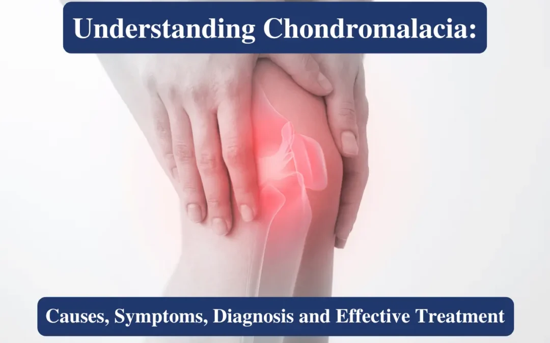 What is Chondromalacia Patella?