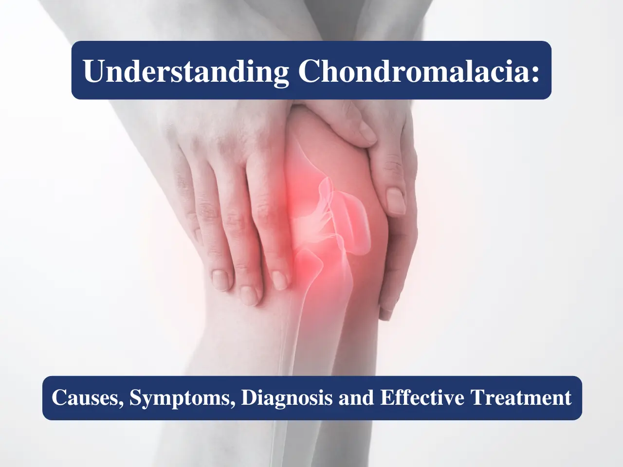 Chondromalacia Causes, Symptoms, Diagnosis & Treatment