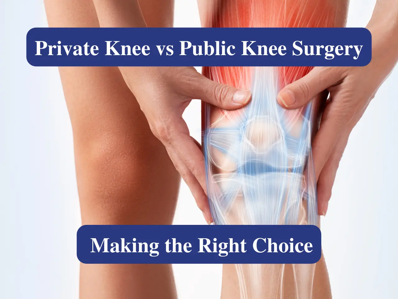 Private Knee vs Public Knee Surgery Making the Right Choice