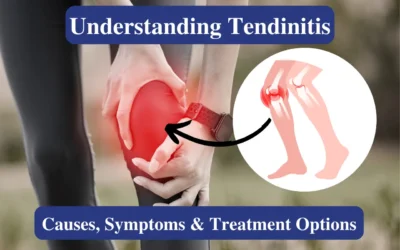 Tendinitis Causes Symptoms and Treatment