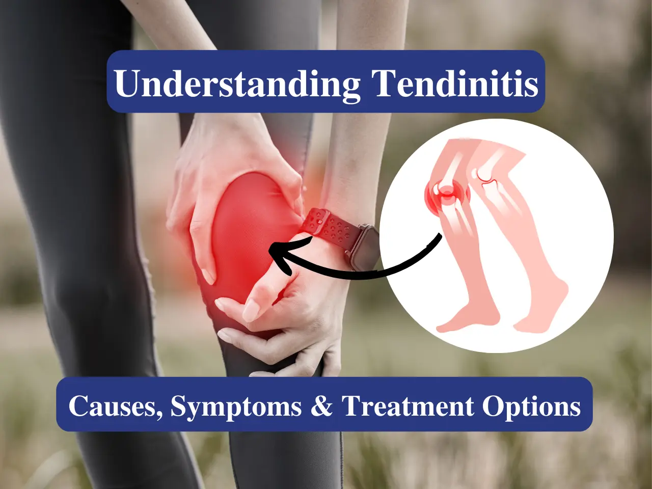 Understanding Tendinitis Causes, Symptoms & Treatment Options