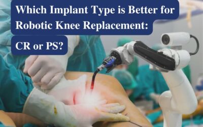 CR vs PS Implants for Robotic Knee Replacement