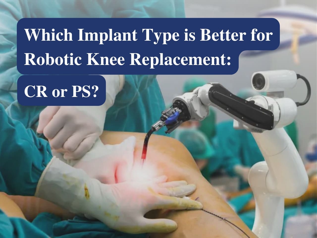 differences between CR and PS implants