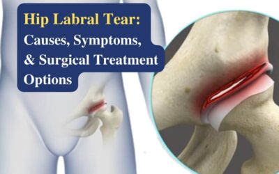 Hip Labral Tear: Causes, Symptoms, and Surgical Treatment