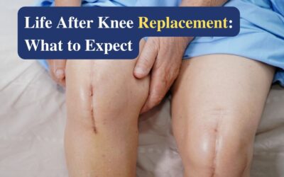 Life After Knee Replacement Surgery