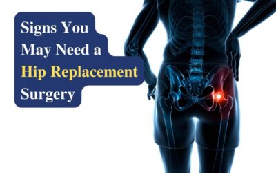 Signs You May Need Hip Replacement Surgery