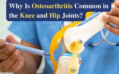 Why is Osteoarthritis Common in the Knee and Hip Joints?