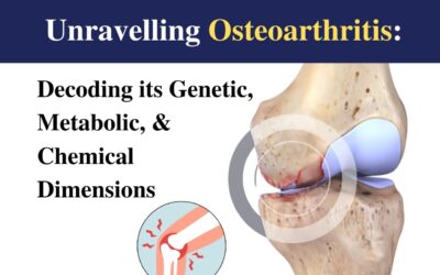 Unravelling Osteoarthritis: Causes, Symptoms, and Treatment