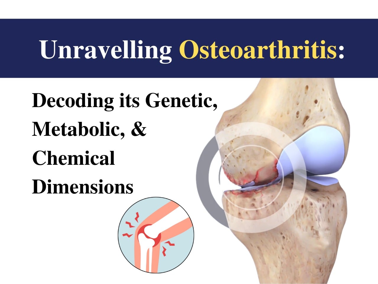 Unravelling Osteoarthritis