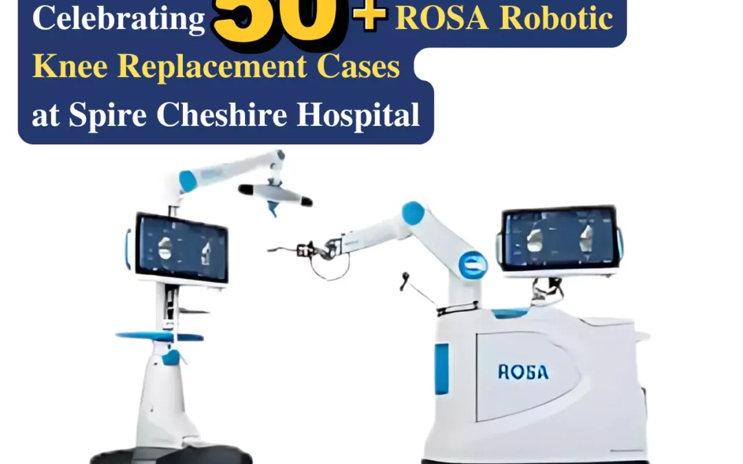 Celebrating 50+ ROSA Robotic Knee Surgeries at Spire Cheshire Hospital