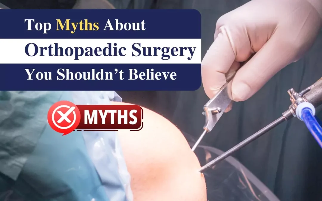 Top Myths About Orthopaedic Surgery