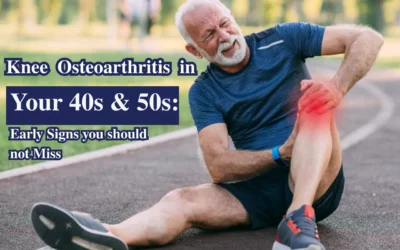 Knee Osteoarthritis in Your 40s & 50s