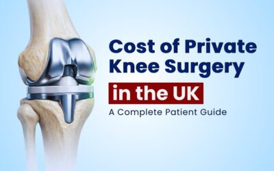 Cost of Private Knee Surgery in the UK