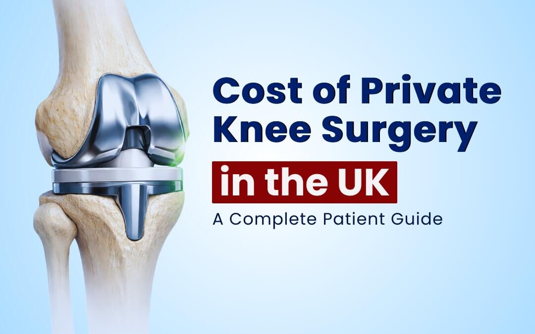 Cost of Private Knee Surgery in the UK