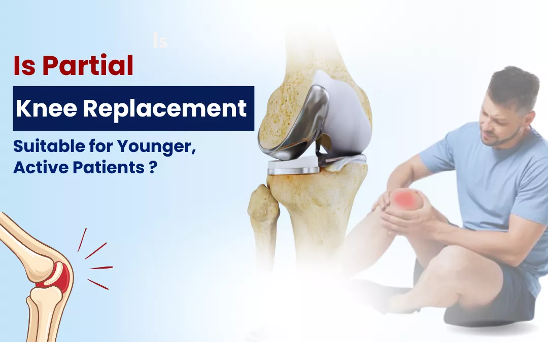 is-partial-knee-replacement-suitable-for-younger-active-patients is-partial-knee-replacement-suitable-for-younger-active-patients
