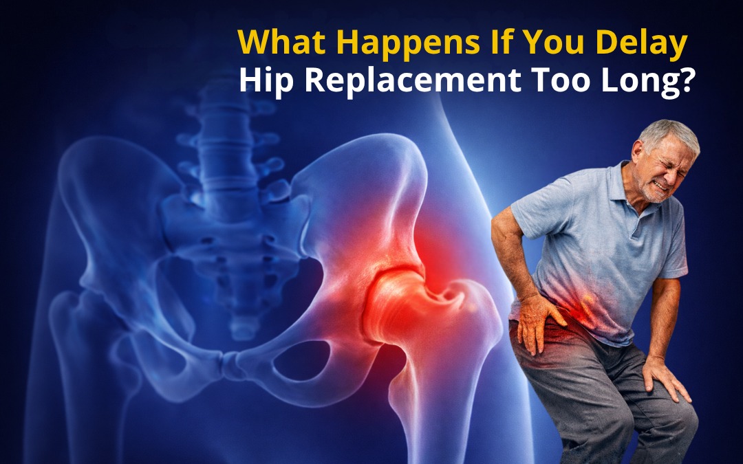 IMG_2882.JPG Hip Replacement Delay