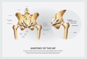 Hip Replacement