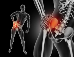 Cemented vs Uncemented Hip Implants